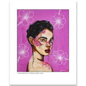 'Imperfectly Perfect: Rosacea', Isobel Lomax. Fine art prints.